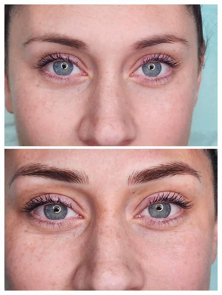 Semi-permanent brows before and after – Skinful Aesthetics, Great Yarmouth