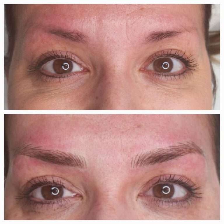 Semi-permanent brows before and after – Skinful Aesthetics, Great Yarmouth
