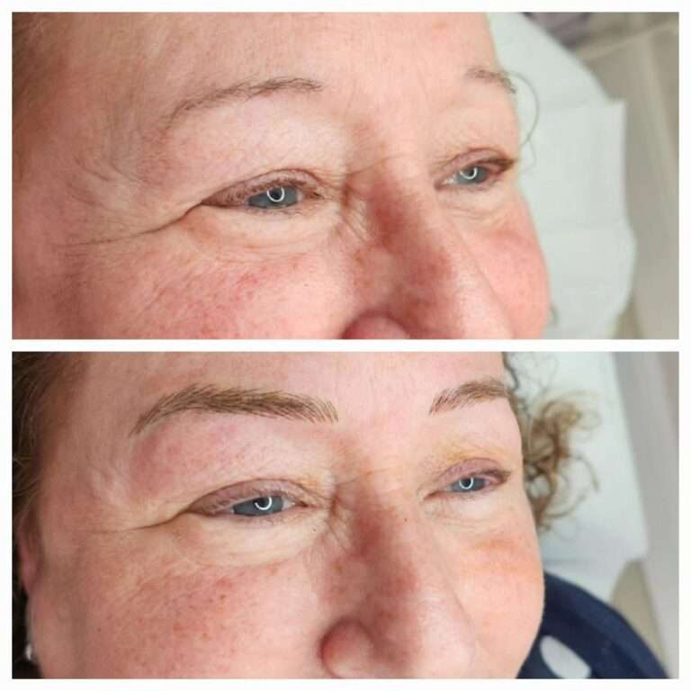 Semi-permanent brows before and after – Skinful Aesthetics, Great Yarmouth