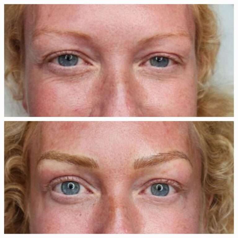 Semi-permanent brows before and after – Skinful Aesthetics, Great Yarmouth