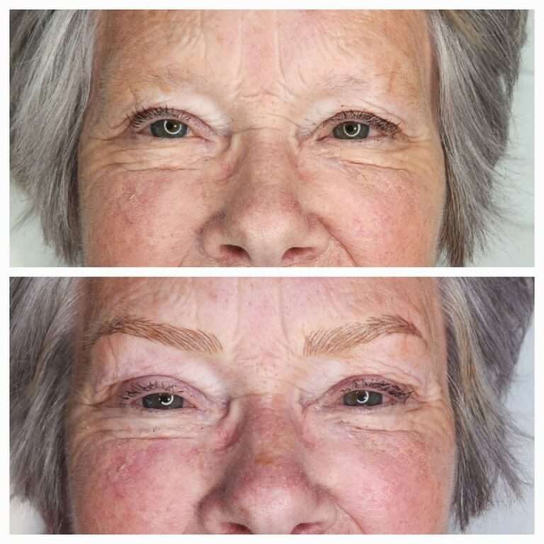 Semi-permanent brows before and after – Skinful Aesthetics, Great Yarmouth