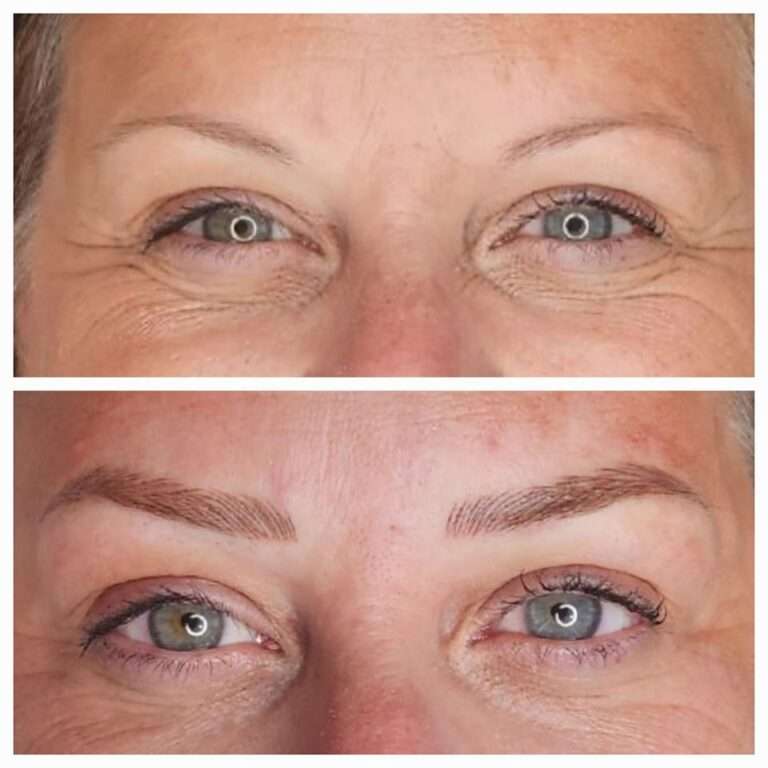 Semi-permanent brows before and after – Skinful Aesthetics, Great Yarmouth