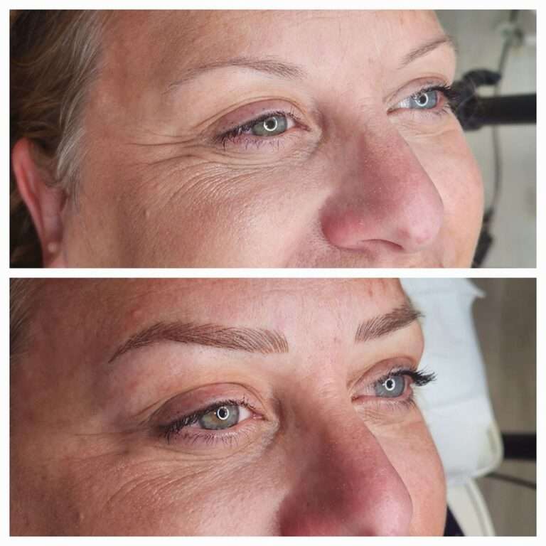 Semi-permanent brows before and after – Skinful Aesthetics, Great Yarmouth