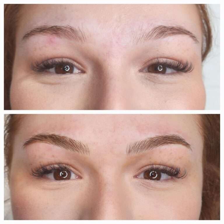 Semi-permanent brows before and after – Skinful Aesthetics, Great Yarmouth