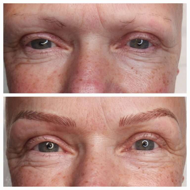 Semi-permanent brows before and after – Skinful Aesthetics, Great Yarmouth