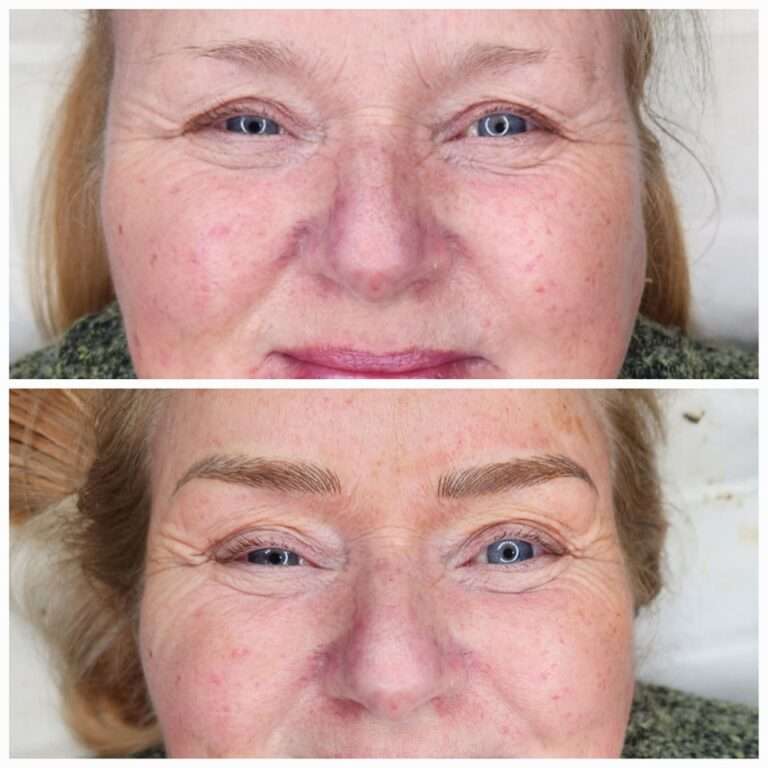 Semi-permanent brows before and after – Skinful Aesthetics, Great Yarmouth