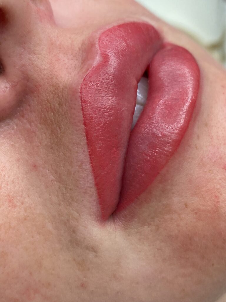 Semi-permanent lips before and after – Skinful Aesthetics, Great Yarmouth