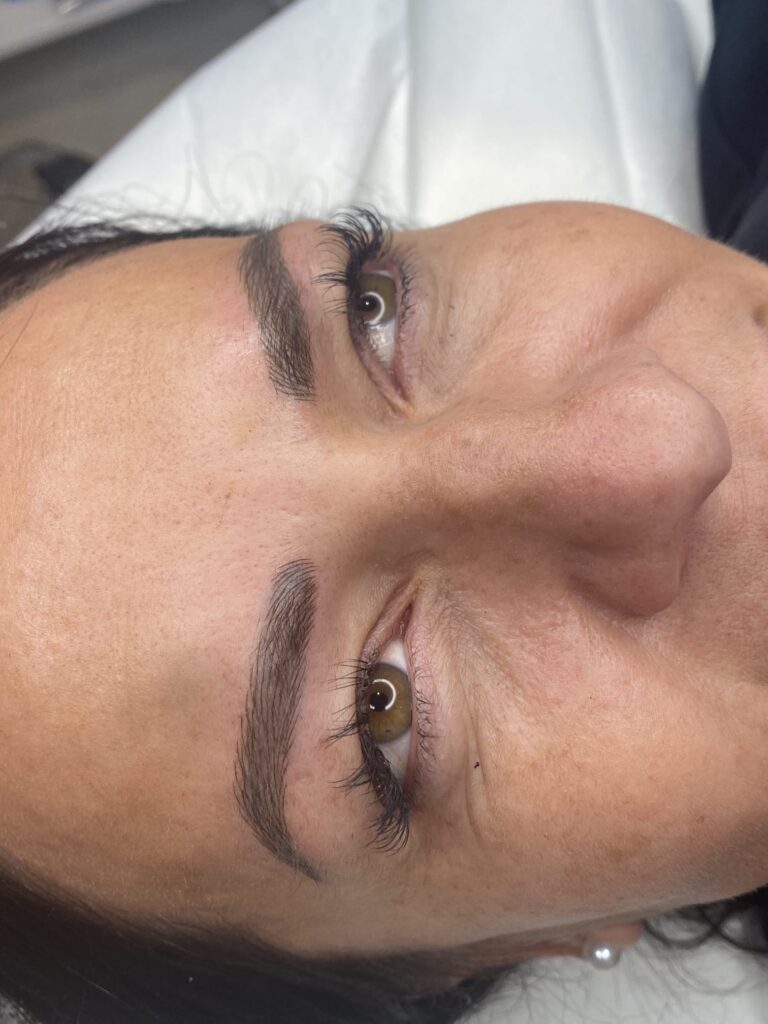 Semi-permanent brows before and after – Skinful Aesthetics, Great Yarmouth